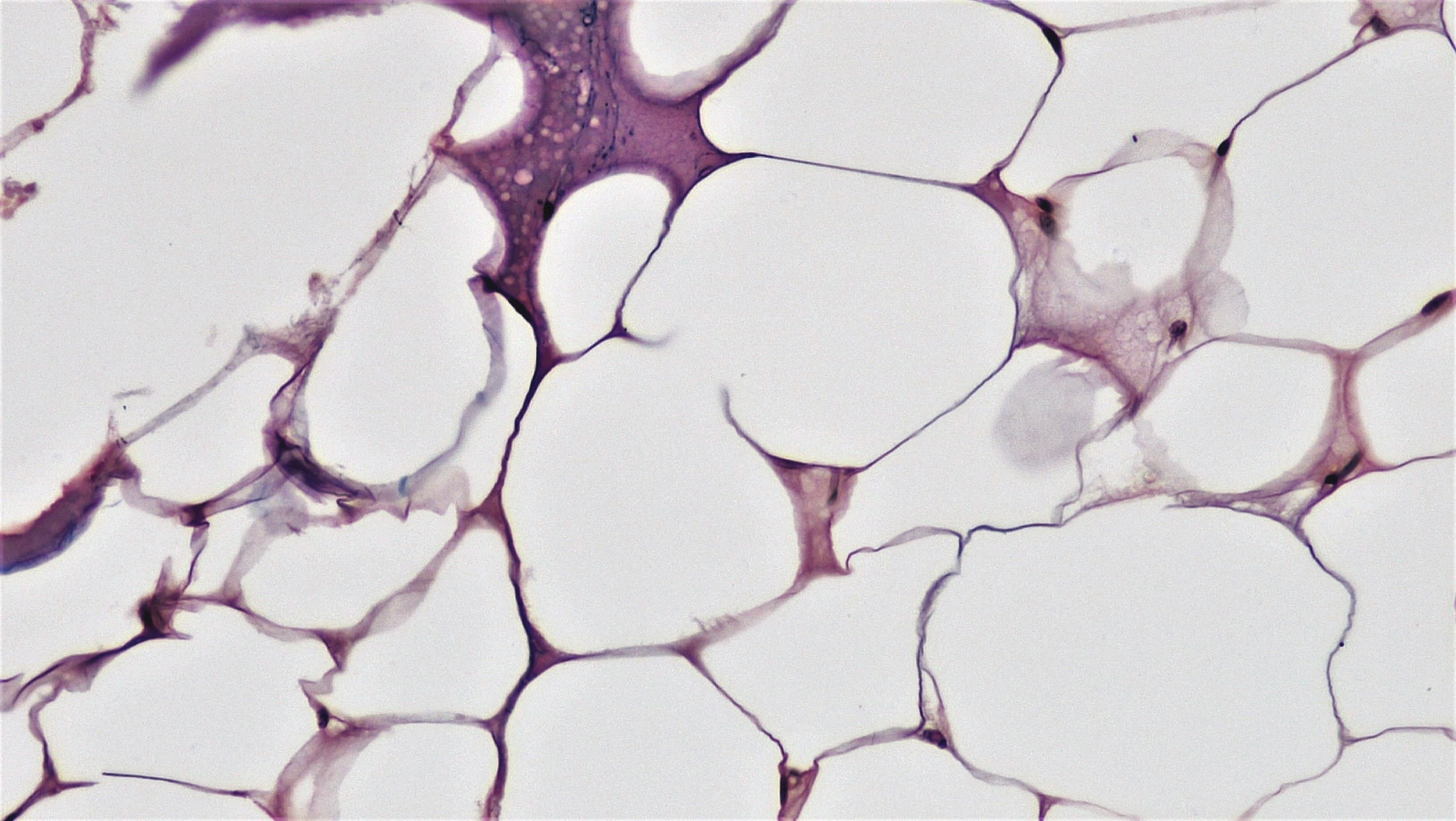 cells1