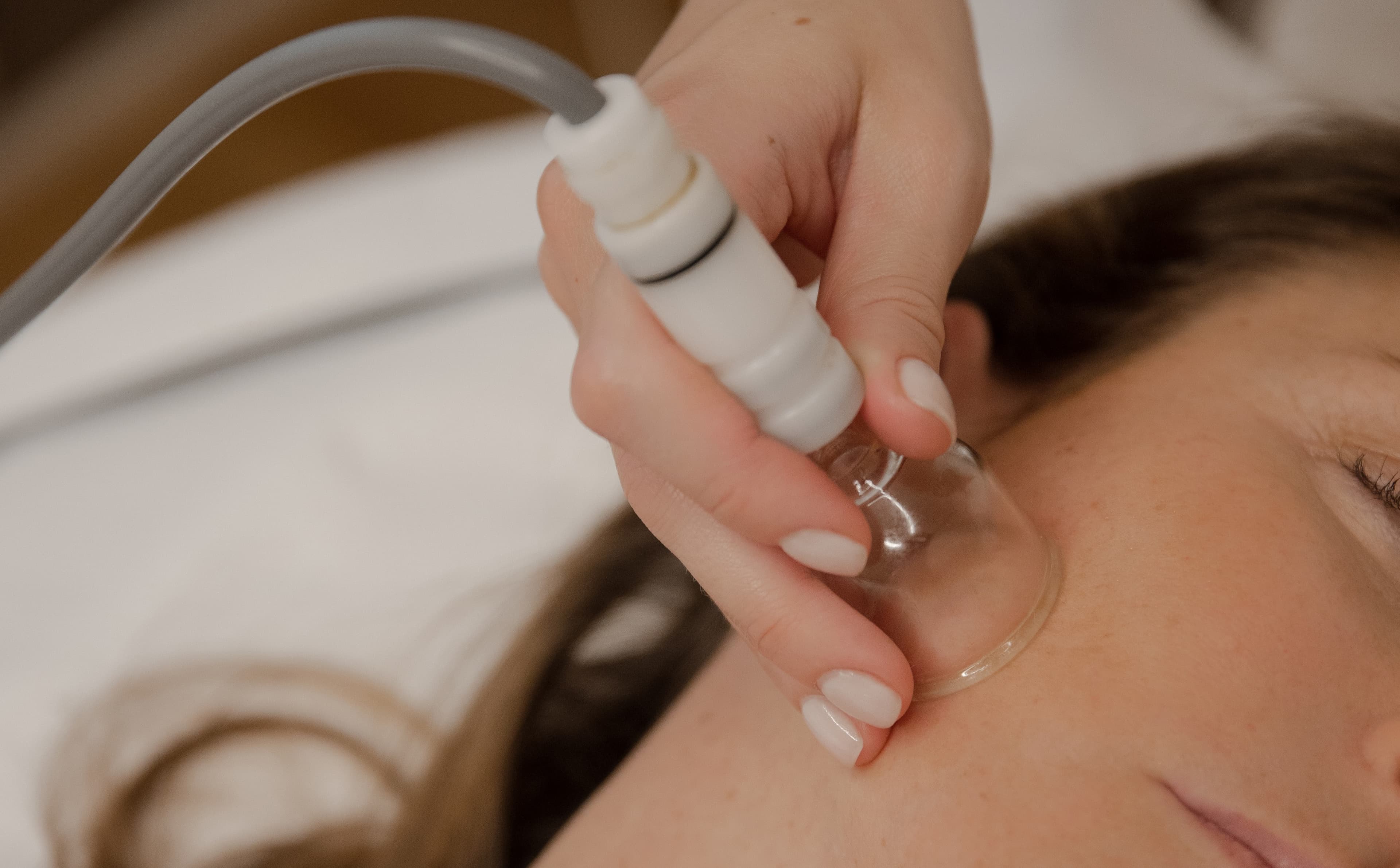 a-cosa-serve-la-coppettazione