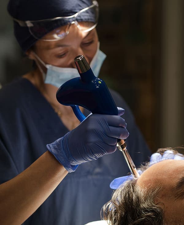 Alopecia, calvizie: conosci il nostro innovativo trapianto di capelli?
