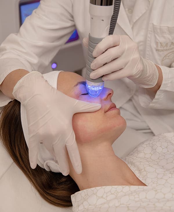 Pori dilatati? Guida rapida ai trattamenti laser